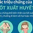 Sốt Xuất Huyết Nên Truyền Dịch Gì